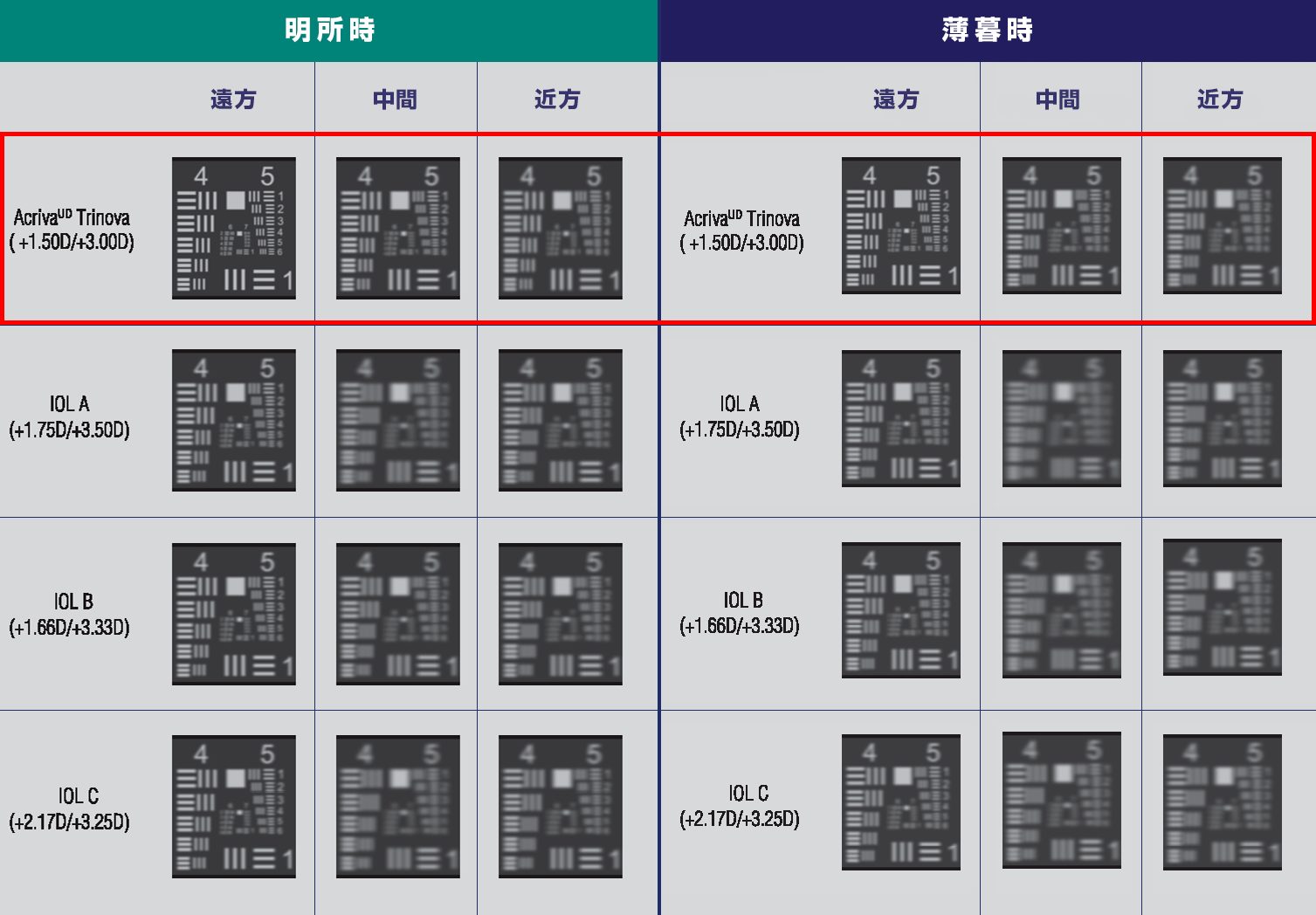 多焦点眼内レンズ手術 金沢文庫アイクリニック